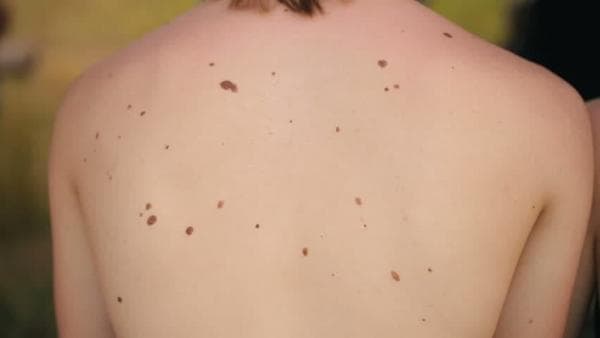 Kenali Tanda Lahir Orang Miskin Menurut Primbon Jawa, Apakah ada di Anda? Kenali Tanda Lahir Orang Miskin Menurut Primbon Jawa, Apakah ada di Anda?