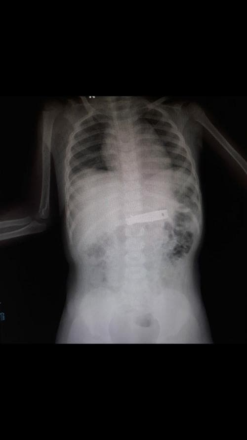 Simak Kisaran Biaya Rontgen Tulang Belakang Simak Kisaran Biaya Rontgen Tulang Belakang