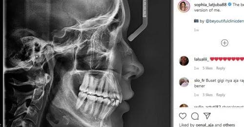 Simak Kisaran Biaya Rontgen Gigi di Puskesmas Simak Kisaran Biaya Rontgen Gigi di Puskesmas