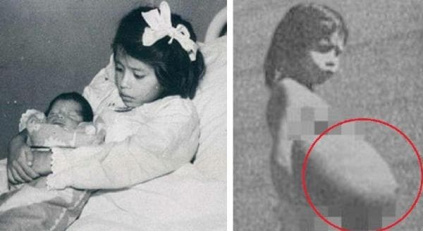 Bocah Ini Jadi Ibu Termuda di Dunia, Berumur 5 Tahun Sudah Melahirkan Bayi Laki-laki Bocah Ini Jadi Ibu Termuda di Dunia, Berumur 5 Tahun Sudah Melahirkan Bayi Laki-laki