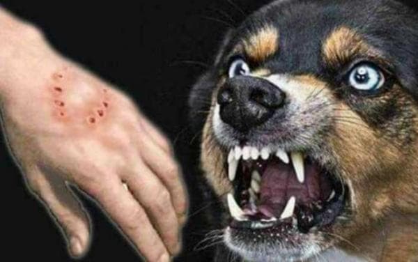 Waspada! Rabies Dapat Tertular pada Manusia, Begini Ciri-Ciri dan Penangananya