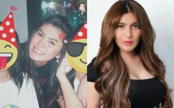 5 Potret Dulu vs Sekarang Angela Lee yang Sempat Tak Sadarkan Diri 2 Hari usai Kecelakaan 5 Potret Dulu vs Sekarang Angela Lee yang Sempat Tak Sadarkan Diri 2 Hari usai Kecelakaan