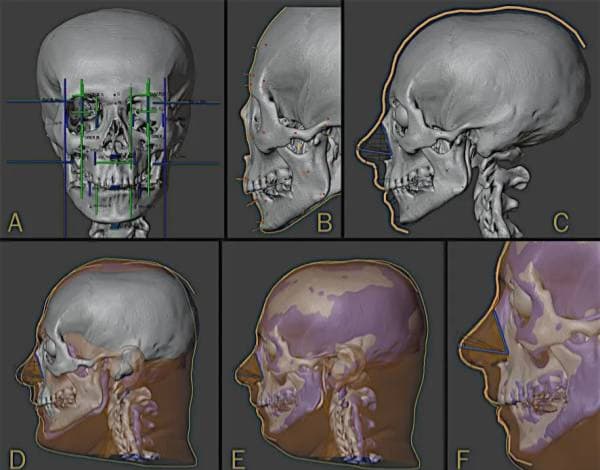 Ilmuwan dari 3 Negara Ungkap Wajah Firaun, Begini Ternyata Bentuknya Ilmuwan dari 3 Negara Ungkap Wajah Firaun, Begini Ternyata Bentuknya