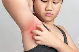 Ketiak Gatal Sering Bikin Malu, Ini Solusinya Ketiak Gatal Sering Bikin Malu, Ini Solusinya