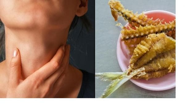 Duri Ikan Nyangkut di Tenggorokan, Begini 5 Cara Mudah Menghilangkannya Duri Ikan Nyangkut di Tenggorokan, Begini 5 Cara Mudah Menghilangkannya