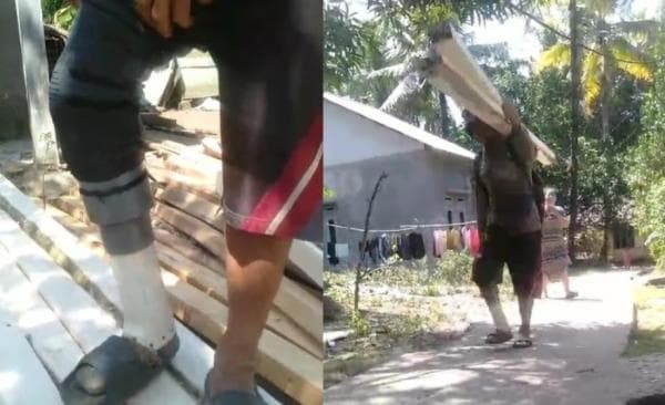 Kasihan! Tak Mampu Membeli, Pria Korban Gigitan Ular di Lebak Terpaksa Buat Kaki Palsu dari Paralon