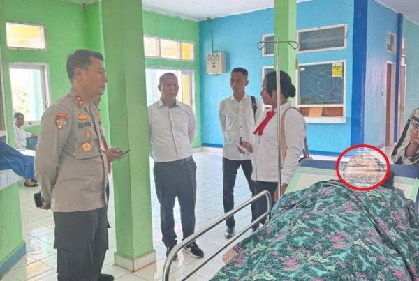 Penyiraman Air Keras Terhadap Siswi SMP di Lembata, Polisi Kejar Pelaku Berhijab