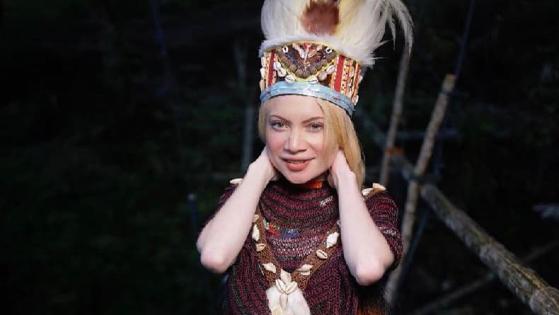 Potret Herolena, Gadis Albino asal Papua Barat yang Mirip Barbie Hidup Potret Herolena, Gadis Albino asal Papua Barat yang Mirip Barbie Hidup