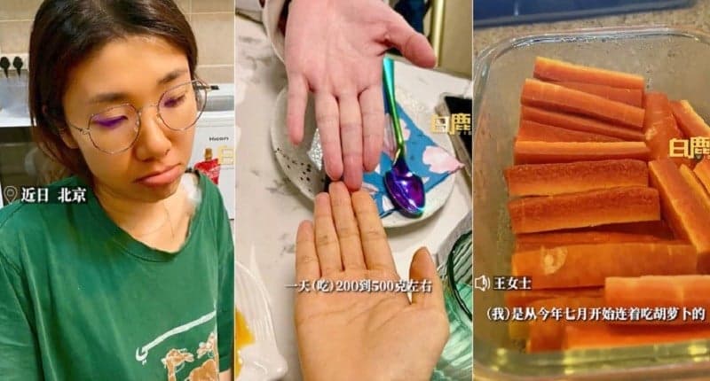 Diet Cuma Makan Wortel, Kulit Seorang Perempuan Berubah Warna Jadi Oranye Diet Cuma Makan Wortel, Kulit Seorang Perempuan Berubah Warna Jadi Oranye