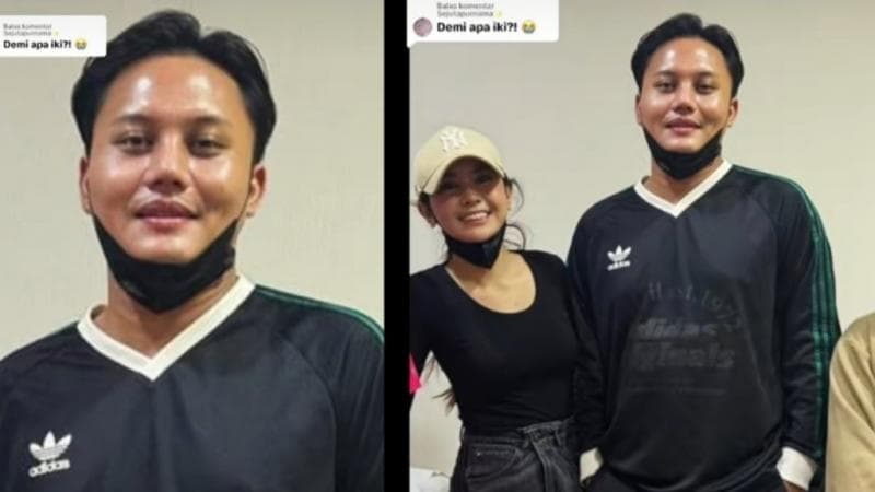 Selain Mahalini, Rizky Febian Ikut operasi Hidung Tampilannya Bikin Pangling