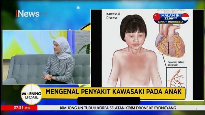 Morning Update: Penyakit Kawasaki Tidak Menular, Begini Cara Mengobatinya