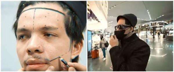 9 Potret Atta Halilintar usai transplantasi rambut, pede tanpa bandana 9 Potret Atta Halilintar usai transplantasi rambut, pede tanpa bandana