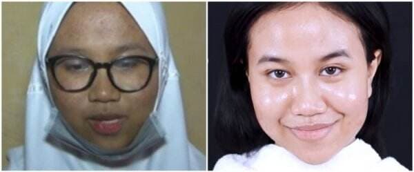 7 Potret Mayang sebelum dan sesudah perawatan wajah, habis Rp 80 juta