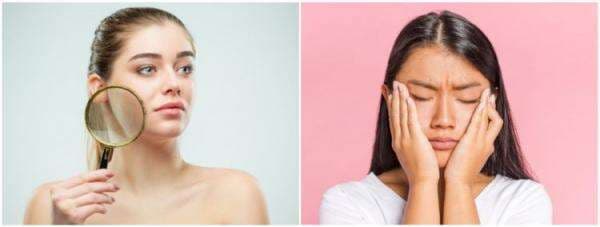 9 Rekomendasi skincare untuk memperbaiki skin barrier, lembapkan kulit 9 Rekomendasi skincare untuk memperbaiki skin barrier, lembapkan kulit