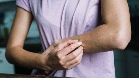 Tanda Penyakit Ginjal juga Bisa Muncul di Kulit, Perhatikan Begini Cirinya... Tanda Penyakit Ginjal juga Bisa Muncul di Kulit, Perhatikan Begini Cirinya...