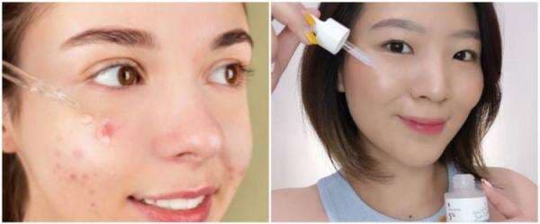 Manfaat serum Somethinc untuk jerawat, ini 5 jenis yang bisa kamu coba Manfaat serum Somethinc untuk jerawat, ini 5 jenis yang bisa kamu coba