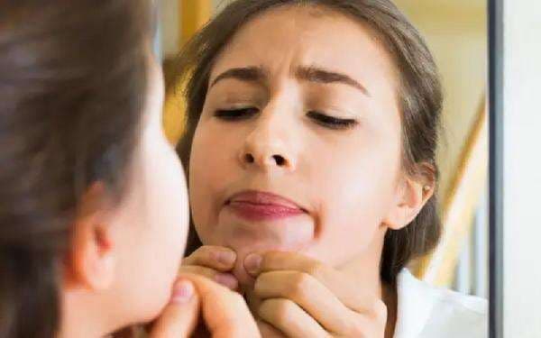 10 Arti Letak Jerawat di Wajah, Bagian Bibir Pertanda Gangguan Pencernaan 10 Arti Letak Jerawat di Wajah, Bagian Bibir Pertanda Gangguan Pencernaan