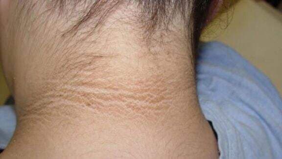 10 Gejala Penyakit Kencing Manis yang Sering Disepelekan, Waspada Ya Moms! 10 Gejala Penyakit Kencing Manis yang Sering Disepelekan, Waspada Ya Moms!