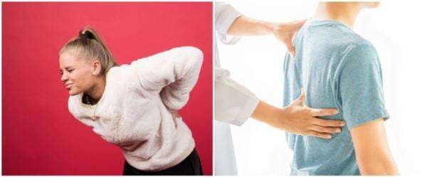 Skoliosis adalah kelainan tulang belakang, ini gejala dan penyebabnya Skoliosis adalah kelainan tulang belakang, ini gejala dan penyebabnya