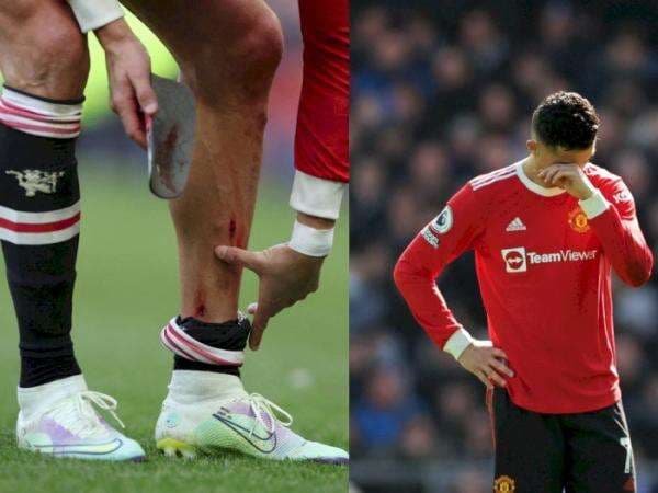 MU Kalah, Kaki Ronaldo Berdarah hingga Banting HP Fans Everton, Ujungnya Minta Maaf MU Kalah, Kaki Ronaldo Berdarah hingga Banting HP Fans Everton, Ujungnya Minta Maaf