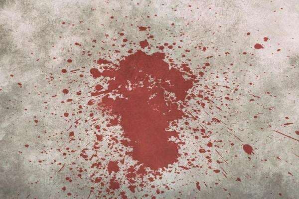 5 Arti Mimpi Melihat Darah, Menurut Primbon Jawa Tengah Dilanda Kekhawatiran 5 Arti Mimpi Melihat Darah, Menurut Primbon Jawa Tengah Dilanda Kekhawatiran