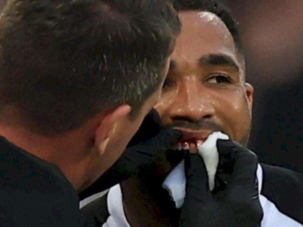 Baru Pulih Cedera Betis, Gigi Striker Newcastle Ini Copot Pula saat Hadapi Arsenal Baru Pulih Cedera Betis, Gigi Striker Newcastle Ini Copot Pula saat Hadapi Arsenal