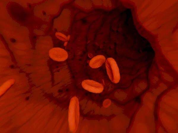 Jumlah Trombosit Normal Orang Dewasa, Anak-Anak, dan Lansia Jumlah Trombosit Normal Orang Dewasa, Anak-Anak, dan Lansia