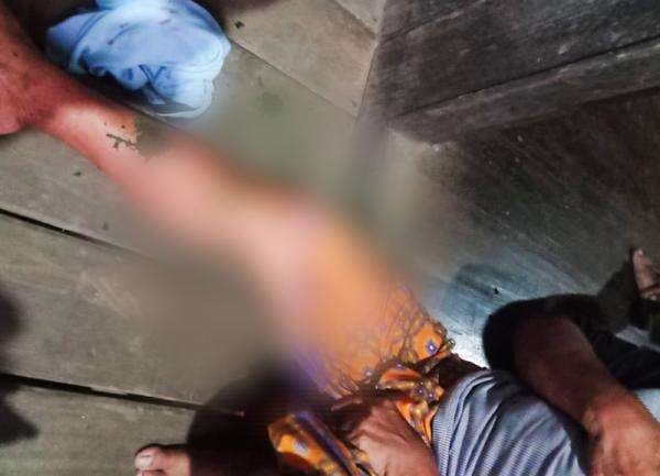 Buaya Liar Beraksi Lagi di Kotabaru, Sambar Kaki Wanita Bangkalaan Dayak Buaya Liar Beraksi Lagi di Kotabaru, Sambar Kaki Wanita Bangkalaan Dayak