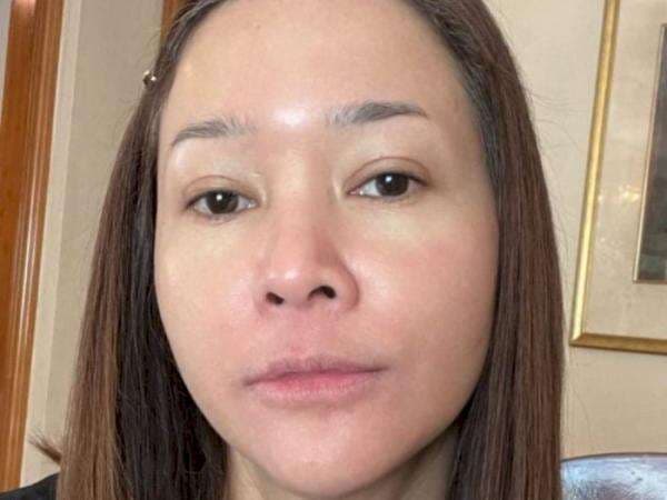 Maia Estianty Pamer Wajah Kemerahan Akibat Penyakit Rosacea, Tetap Cantik Tanpa Makeup Maia Estianty Pamer Wajah Kemerahan Akibat Penyakit Rosacea, Tetap Cantik Tanpa Makeup