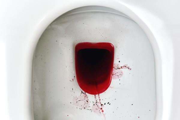 Mengapa Feses Saya Berdarah? Jangan Panik Dulu, Simak Penjelasan Berikut Mengapa Feses Saya Berdarah? Jangan Panik Dulu, Simak Penjelasan Berikut