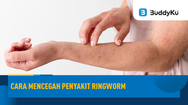 Mengenal Penyakit Ringworm dan Cara Mencegahnya