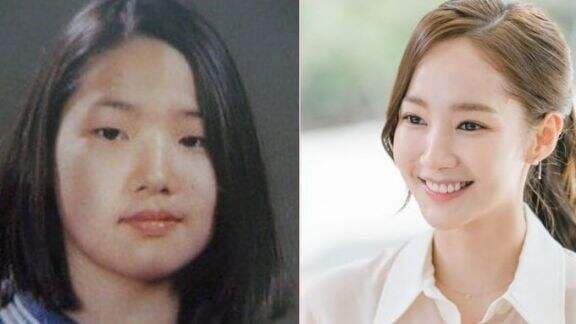 Dijuluki Queens of Surgery, 6 Transformasi Aktris Korea Park Minyoung, hingga Sukses di Dunia Seni Peran