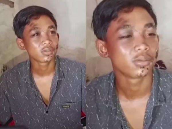 Kesaksian Korban Kanjuruhan, Sedih! Niat Mau Pulang Malah Kena Semprot Gas Air Mata Kesaksian Korban Kanjuruhan, Sedih! Niat Mau Pulang Malah Kena Semprot Gas Air Mata