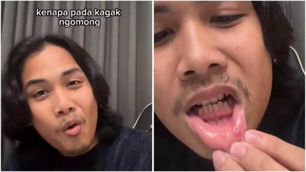 Viral Komika Bintang Emon Kritik PPN 12:  Kenapa Pada Kagak Ngomong, Sariawan?