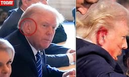 Donald Trump Tampil Tanpa Perban di Telinga Pertama Kalinya Usai Penembakan