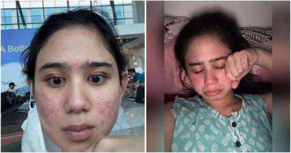 Viral Curhatan Tissa Biani Jerawatan Parah selama 4 Tahun, sekarang Membaik gegara Satu Hal Ini Viral Curhatan Tissa Biani Jerawatan Parah selama 4 Tahun, sekarang Membaik gegara Satu Hal Ini