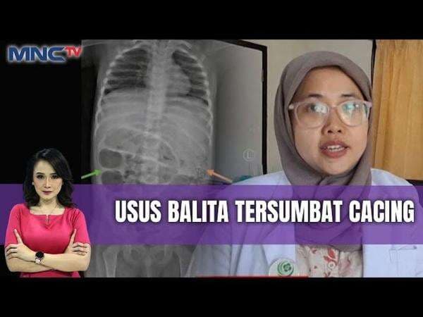 Anak 3 Tahun di Jember Alami Penyumbatan Usus Akibat Ratusan Cacing Anak 3 Tahun di Jember Alami Penyumbatan Usus Akibat Ratusan Cacing