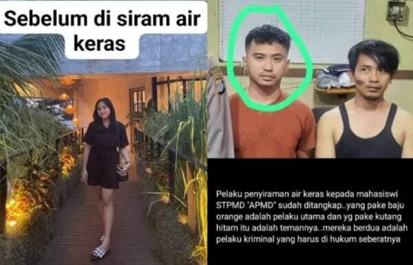 Kronologi Mahasiswi Cantik di Yogyakarta Disiram Air Keras oleh Mantan Pacar