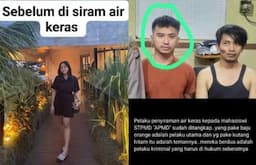 Kronologi Mahasiswi Cantik di Yogyakarta Disiram Air Keras oleh Mantan Pacar