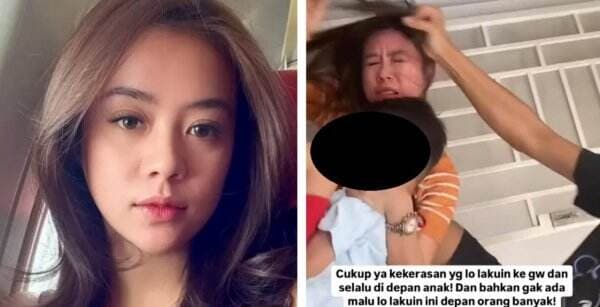 Dianiaya Mantan Suami Depan Anak, Selebgram Cantik Anastasia Noor: Gw Enggak Akan Diam!