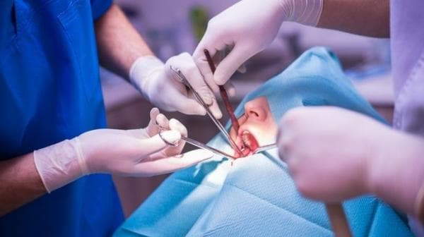 Cek Harga Operasi Gigi Bungsu, Apakah Ditanggung BPJS Kesehatan? Cek Harga Operasi Gigi Bungsu, Apakah Ditanggung BPJS Kesehatan?