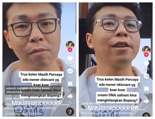 Wajah Asli Dokter Richard Lee Tak Mulus di Kamera Wartawan Viral, Ini Klarifikasinya Wajah Asli Dokter Richard Lee Tak Mulus di Kamera Wartawan Viral, Ini Klarifikasinya