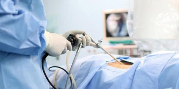 Teknologi VATS, Harapan Baru untuk Pengobatan Penyakit Paru Teknologi VATS, Harapan Baru untuk Pengobatan Penyakit Paru