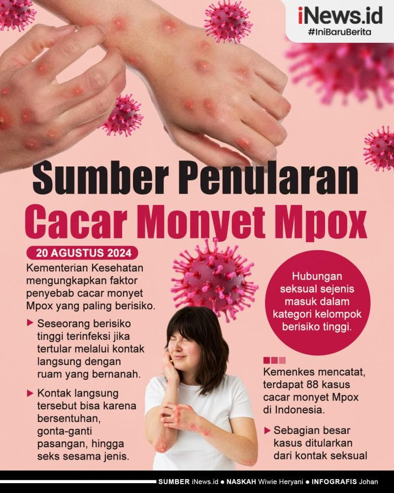 Infografis Gonta-ganti Pasangan dan Seks Sesama Jenis Sumber Penularan Cacar Monyet Mpox Infografis Gonta-ganti Pasangan dan Seks Sesama Jenis Sumber Penularan Cacar Monyet Mpox