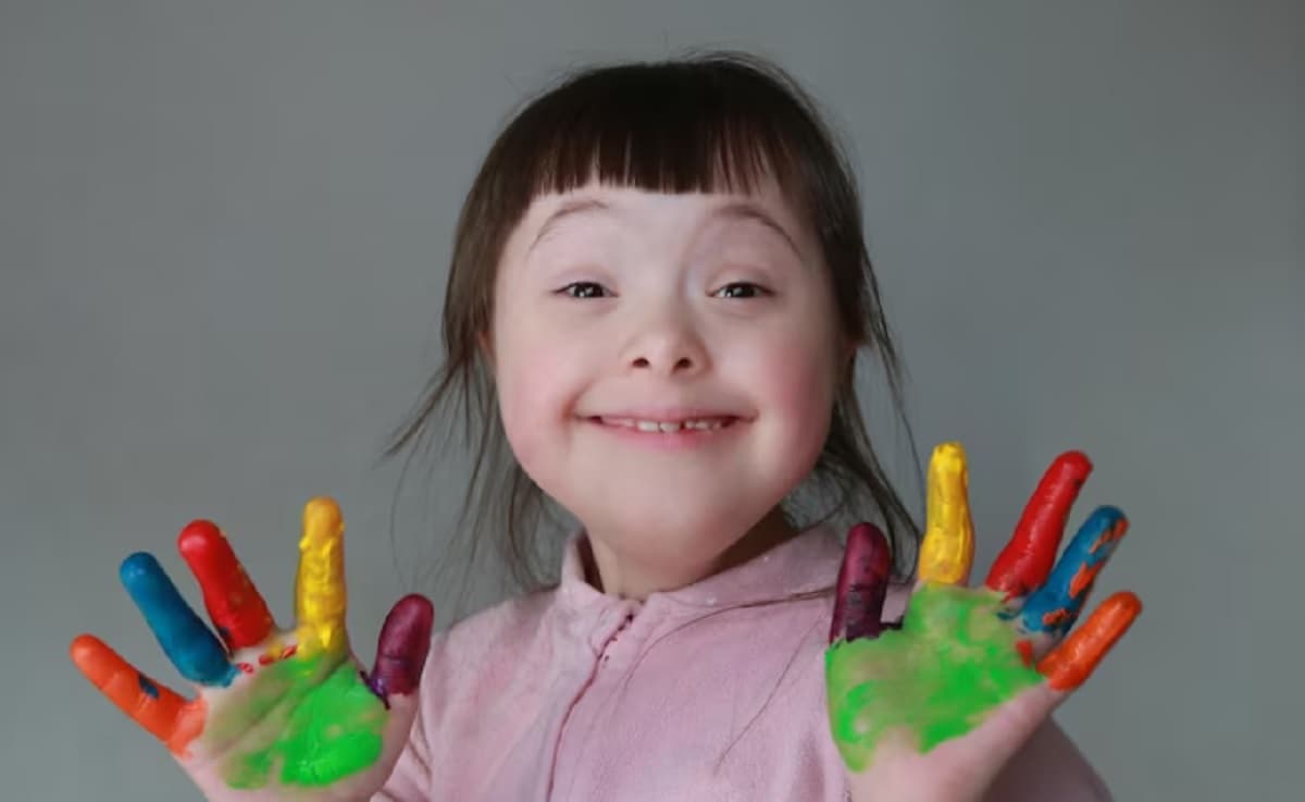 Mengenal Down Syndrom, Penyakit Kelainan Genetik Akibat Kelebihan Kromosom Mengenal Down Syndrom, Penyakit Kelainan Genetik Akibat Kelebihan Kromosom