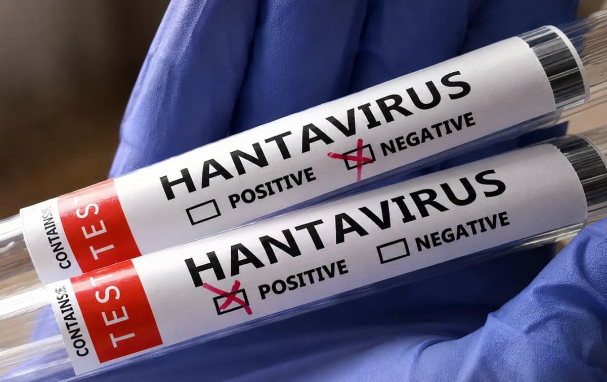 Waspada Hantavirus, Kenali Gejala, Penularan, dan Cara Mencegahnya Waspada Hantavirus, Kenali Gejala, Penularan, dan Cara Mencegahnya