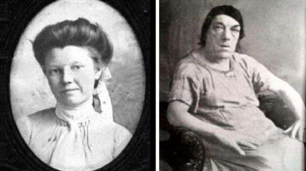 Sosok Mary Ann Bevan, Perawat yang Ikuti Kontes Wanita Terjelek di Dunia demi Keluarga Sosok Mary Ann Bevan, Perawat yang Ikuti Kontes Wanita Terjelek di Dunia demi Keluarga