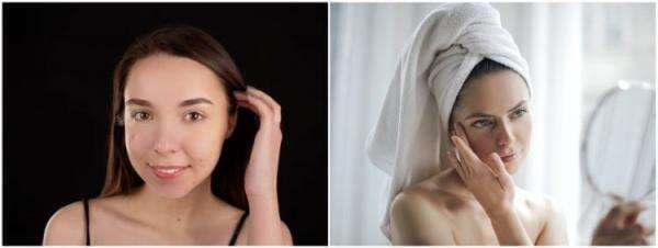 Rekomendasi 9 skincare menghilangkan milia, harga mulai Rp 20 ribu Rekomendasi 9 skincare menghilangkan milia, harga mulai Rp 20 ribu