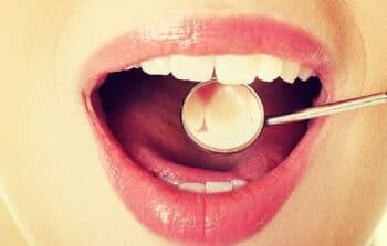 Penyakit Abses Gigi: Penyebab, Gejala dan Cara Mengobati Penyakit Abses Gigi: Penyebab, Gejala dan Cara Mengobati