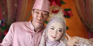 Biodata dan Profil Surya Manurung: Umur, Agama dan Riwayat Penyakit, TikToker Viral Nikahi Gadis Cantik Biodata dan Profil Surya Manurung: Umur, Agama dan Riwayat Penyakit, TikToker Viral Nikahi Gadis Cantik